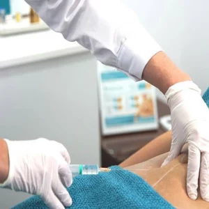 INTRALIPOTERAPIA (AQUALYX) cornella